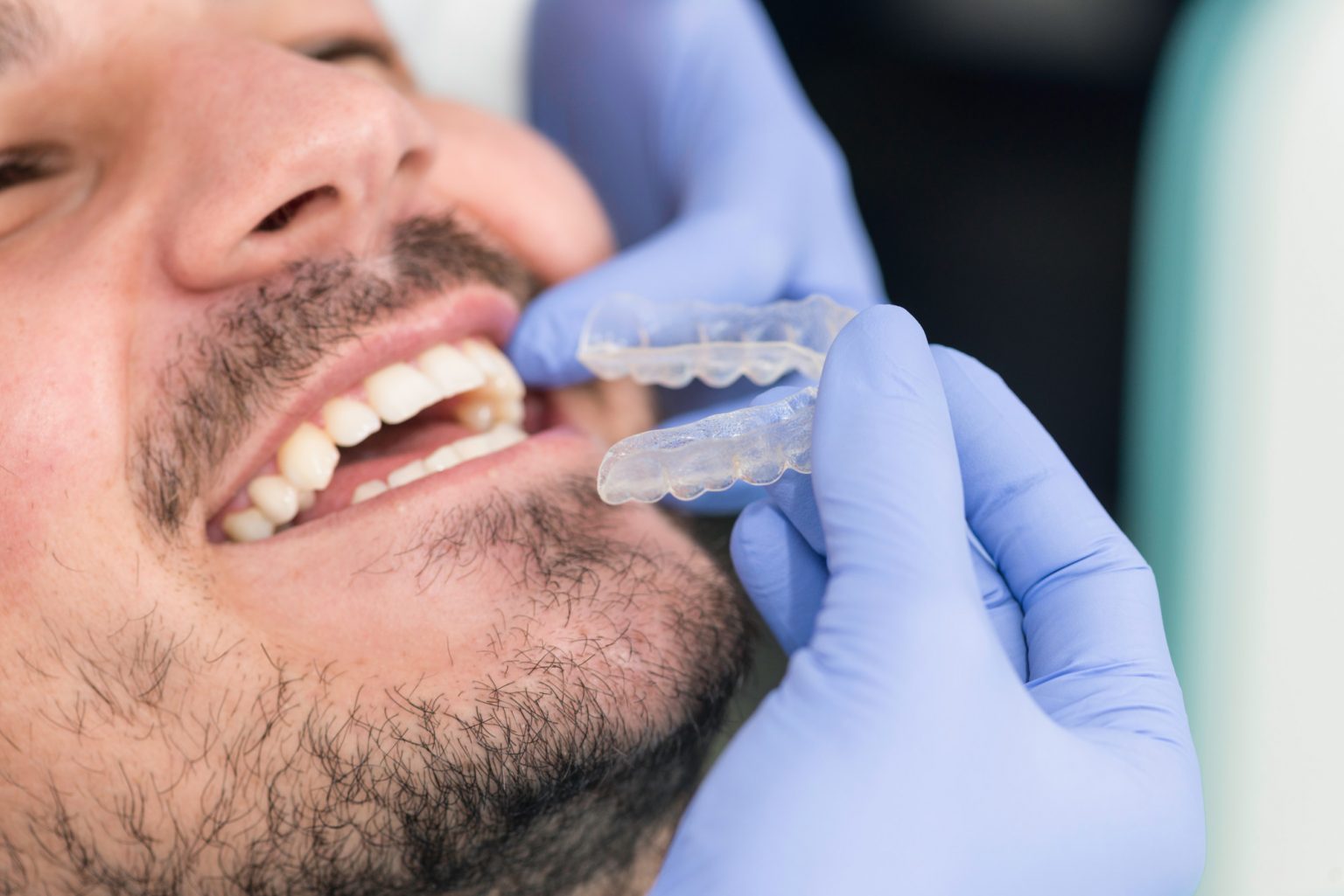 10 Things to Know About the Invisalign Process